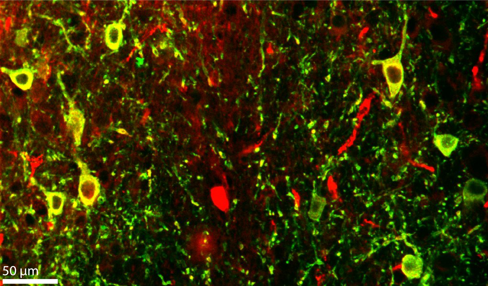 PV-GABAerg idegsejtek fluoreszcens képe a mediális szeptumból