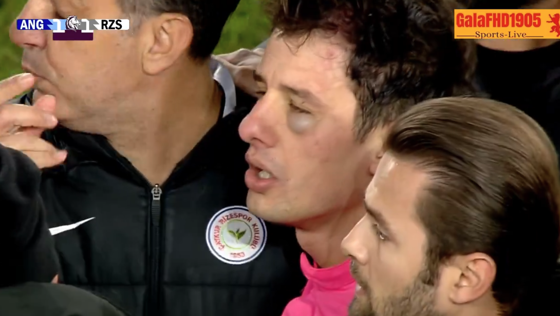 Bődületes pofont kevert le a bírónak a török csapat pályára viharzó klubelnöke