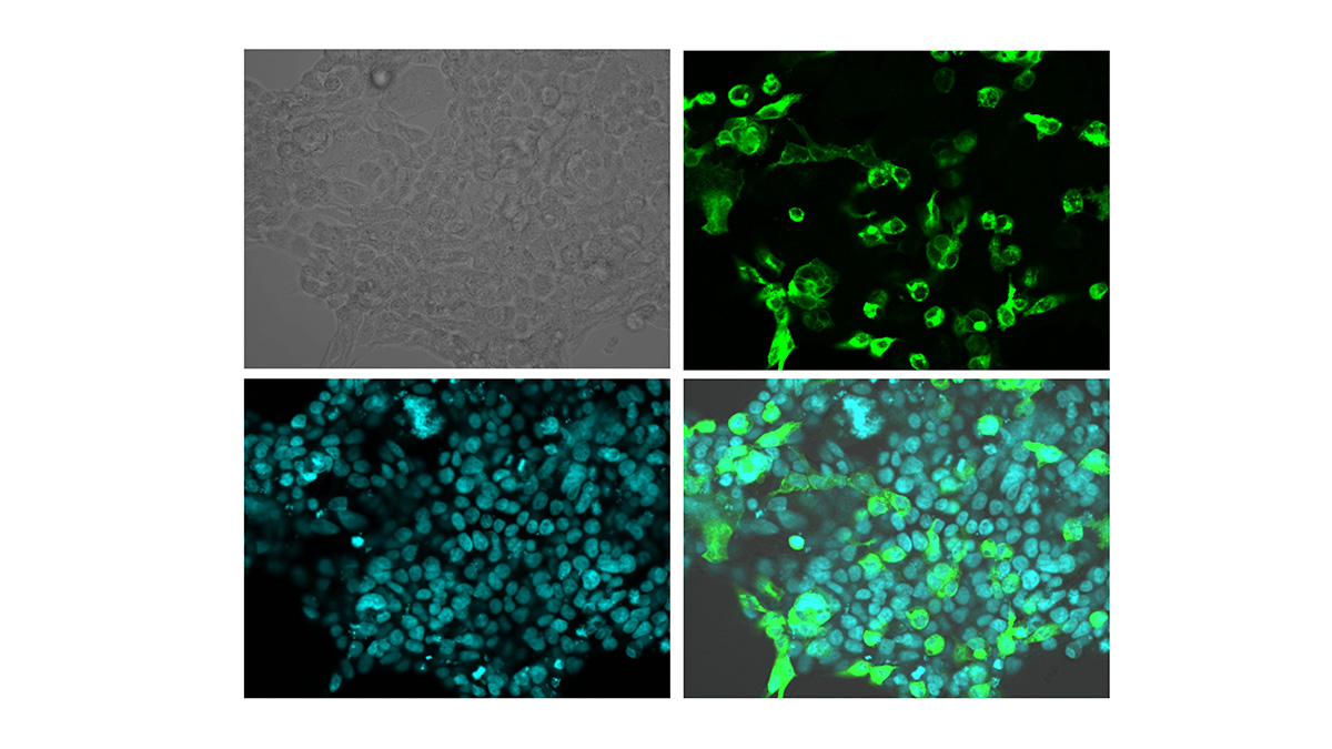 A nagy mocsári csiga idegrendszerében azonosított potenciális membrán ösztrogén receptor homológ expresszálása (zöld) humán embrionális vesesejtekben funkcionális vizsgálatokhoz