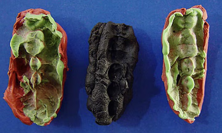 Tízezer éves rágógumi DNS-elemzéséből derült ki a kőkorszaki kamaszok étrendje
