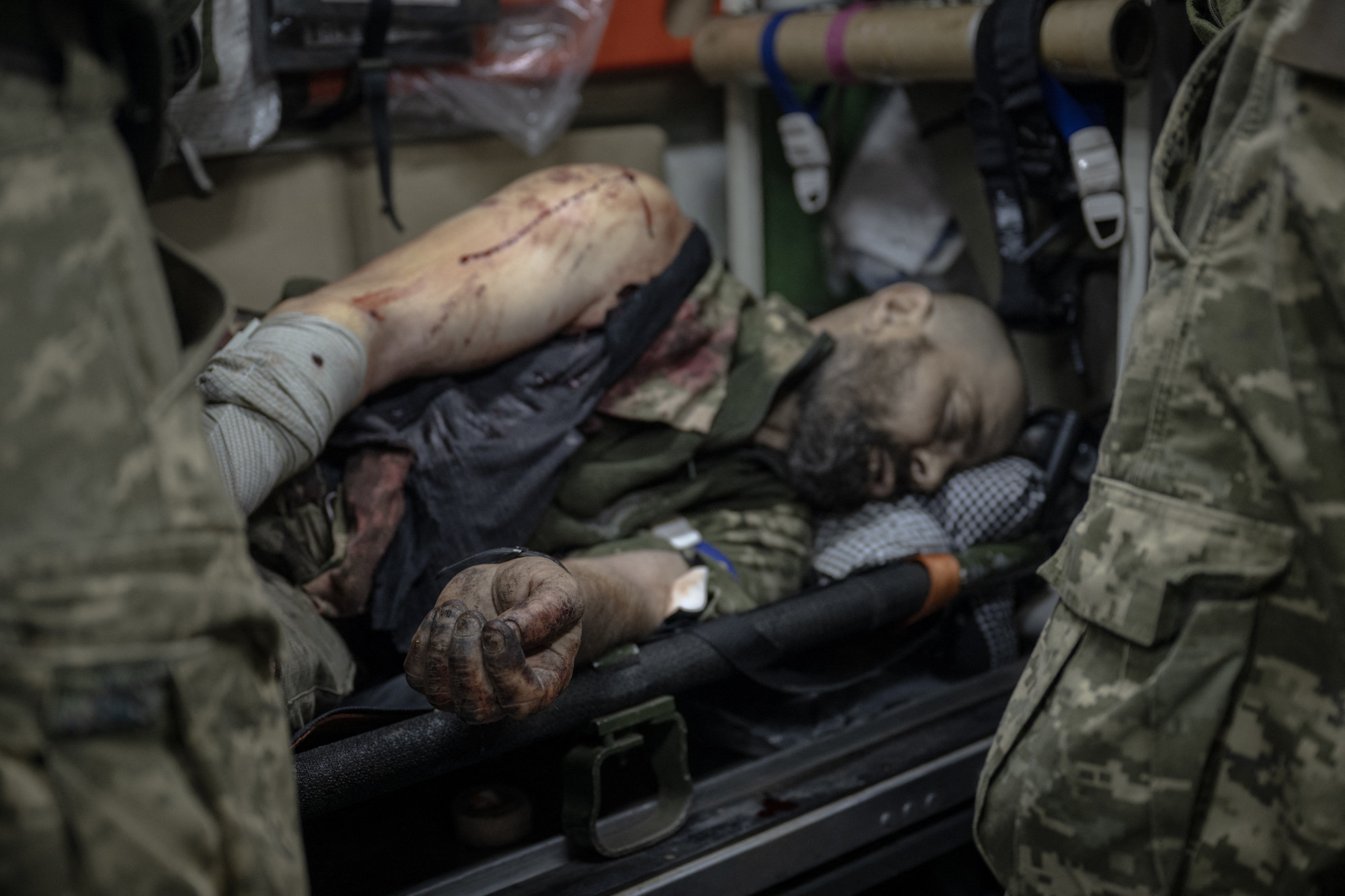 Utolsó pillanatig kérték videóüzenetekben az ukrán sebesültek, hogy evakuálják őket, de csak az oroszok érkeztek: családtagjaik szerint kivégezték őket