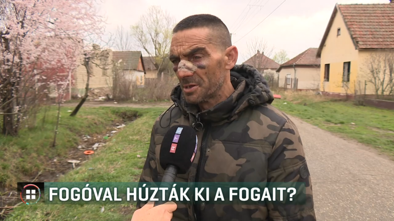 Harapófogóval húzták ki a fogait, kalapáccsal verték, végül kútba dobtak egy jászkarajenői férfit