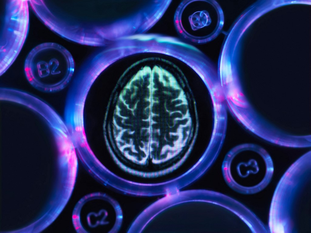 Az Alzheimer-kór újabb genetikai okára derült fény