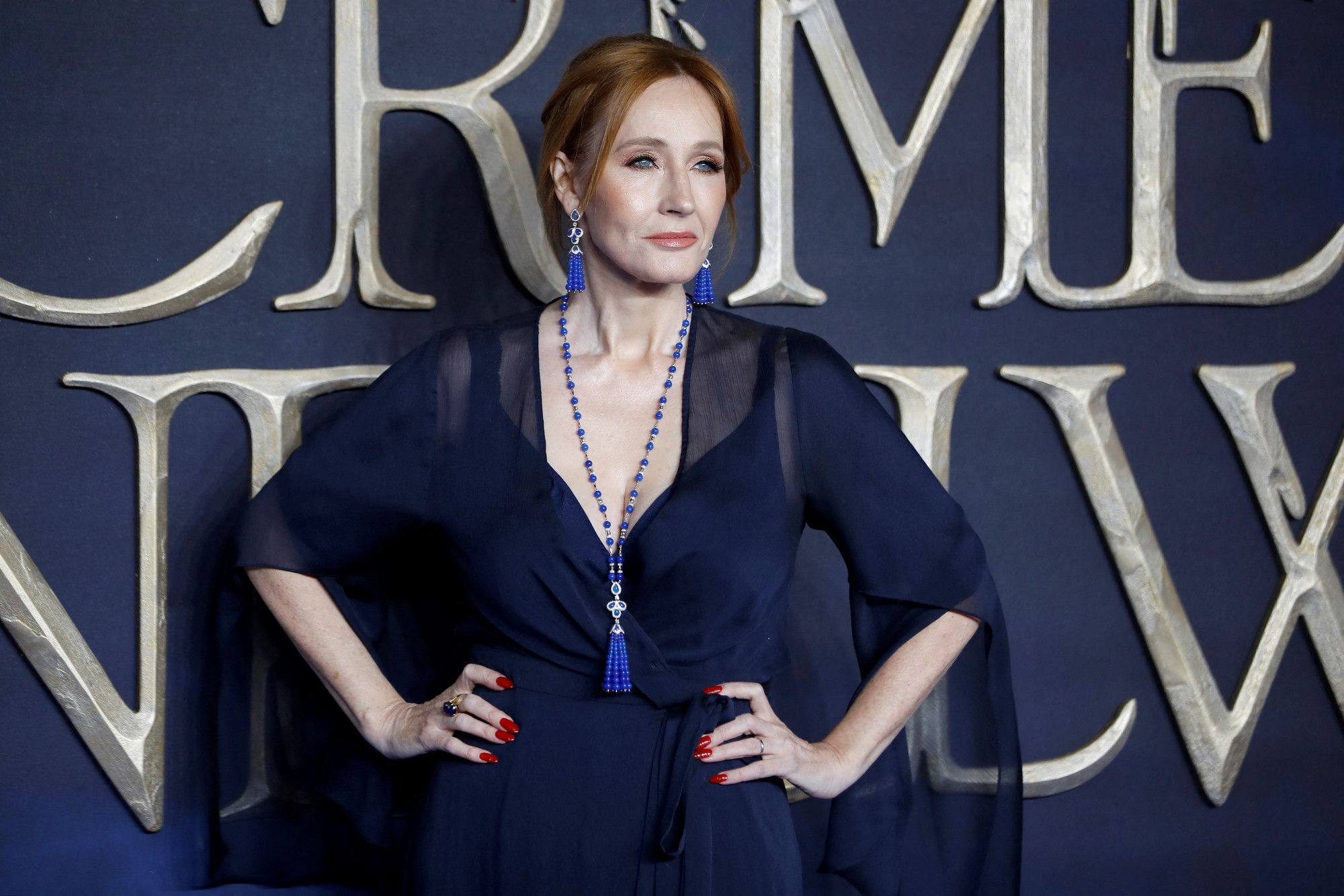 J. K. Rowling most transzfób, transzellenes, TERF vagy egyik sem?