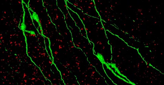 Zölddel a GnRH-idegsejtek, pirossal pedig az acetilkolin-tartalmú idegrostok egy hím egér agyában
