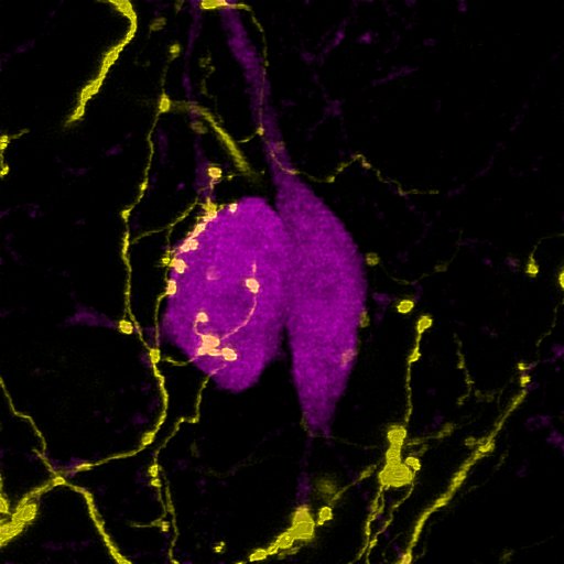 A Broca-féle diagonális köteg parvalbuminos rostjai (sárga) beidegzik a hippokampusz parvalbuminos sejtjeit (lila)