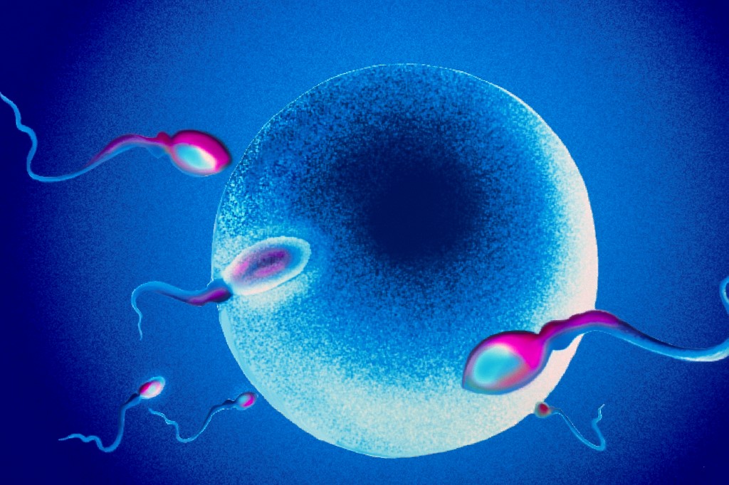 Minden megvizsgált emberi spermamintában talált mikroműanyagokat egy kínai kutatás