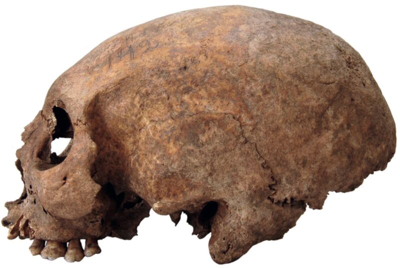 Három megnyújtott női koponya arra utal, hogy a vikingeknél létezett testmódosítás