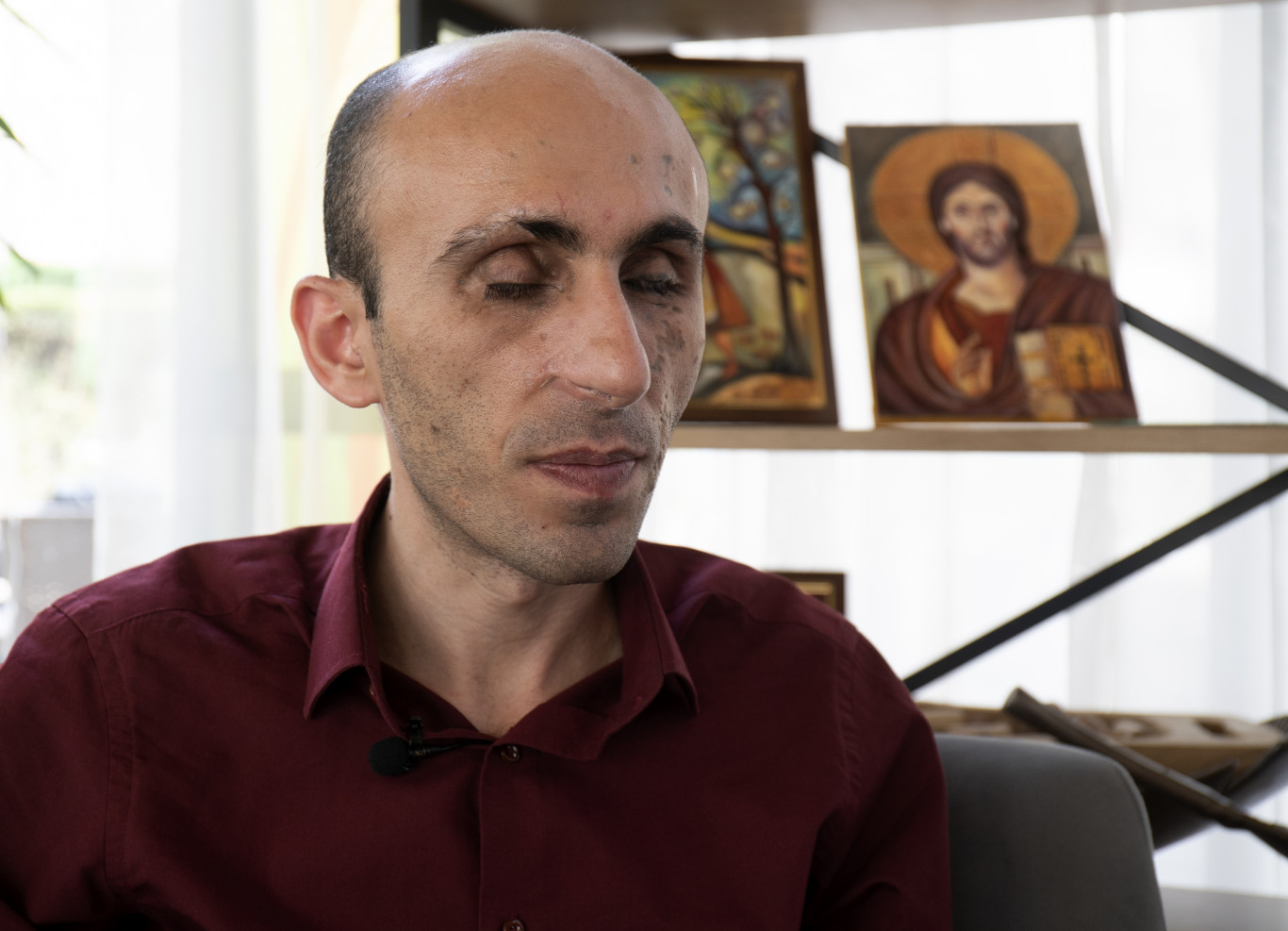 Budapestnek is üzent az örmény jogvédő, akinek gyerekkorában felrobbant a kezében egy akna
