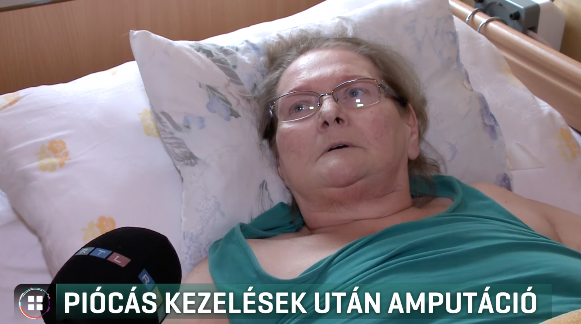 Piócás kezelés után amputálni kellett a lábát a vecsési asszonynak