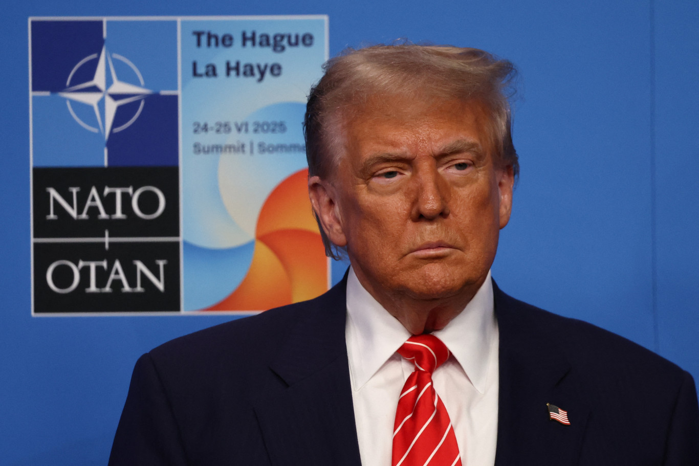 Donald Trump elnök krónikus vénás elégtelenségtől szenved
