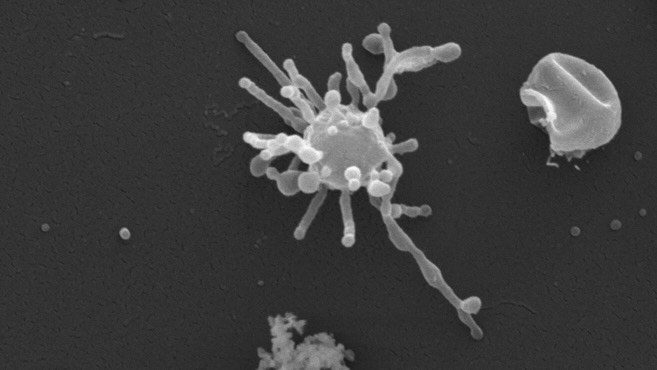 Nem mindennapi mikrobákra bukkantak a 100 ezer éve fagyott permafrosztban