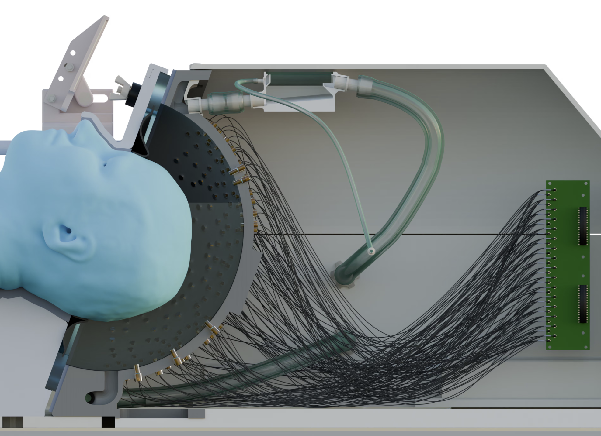 Ultrahangos sisakkal gyógyítanák az idegrendszeri megbetegedéseket