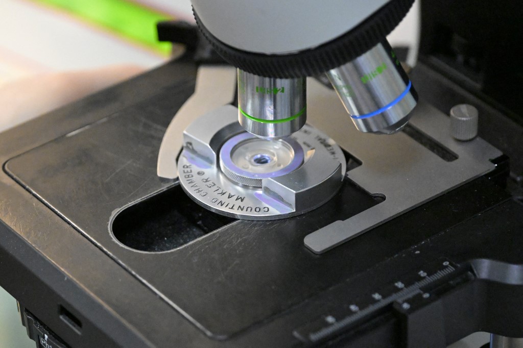 Szegedi fejlesztők új, AI-t is használó megoldása hozhat előrelépést a személyre szabott gyógyászatban