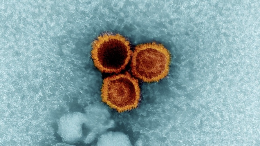 Az Epstein-Barr-vírus okozhatja a lupuszt