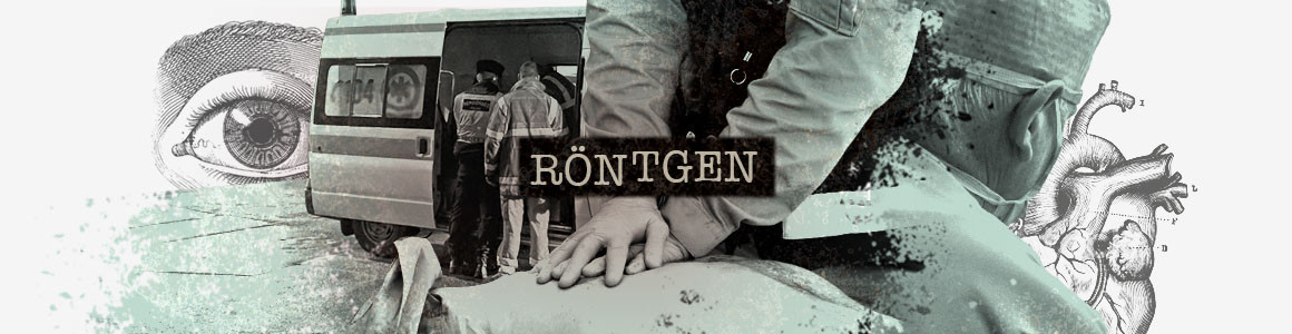 Röntgen kiemelt kép