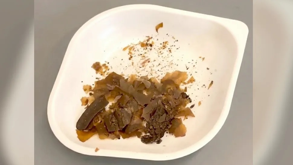 Az ókori rómaiak emberi ürülékkel kezeltek egyes gyulladásokat és fertőzéseket