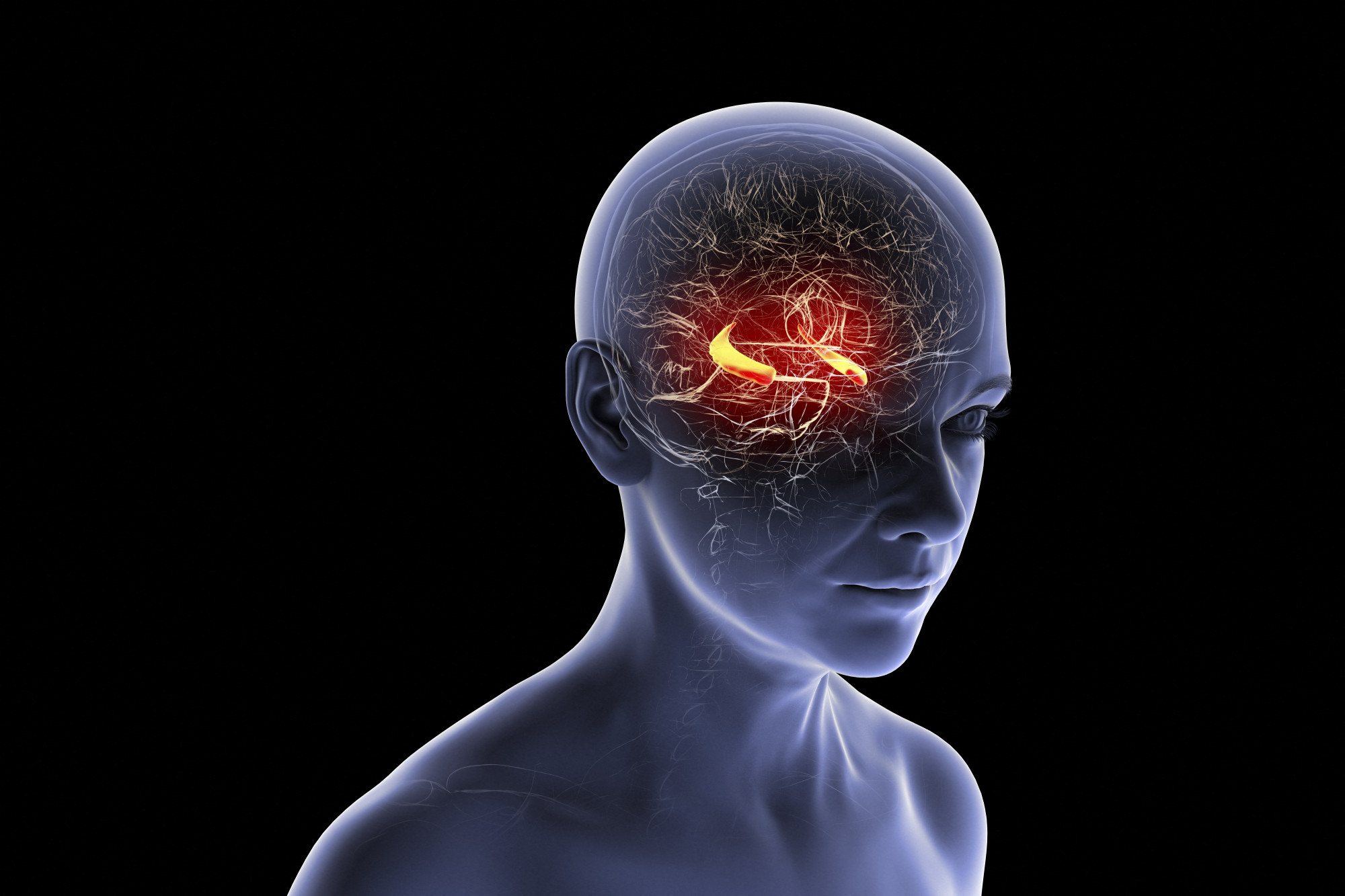 Nemcsak az agyat érintő betegségek okozhatnak demenciát, hanem más szervi elváltozások is