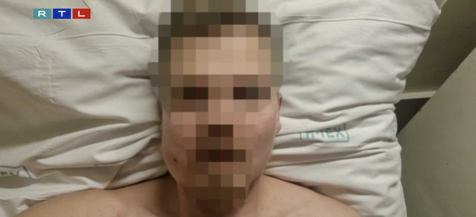 Szenteste otthon arcon ütötték, a veszprémi kórházból kiengedték, végül Ausztriában műtötték meg a Kutyapárt aktivistáját