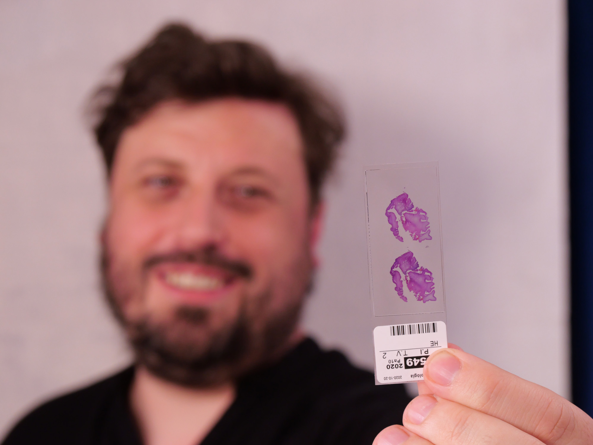 Blurred placeholder